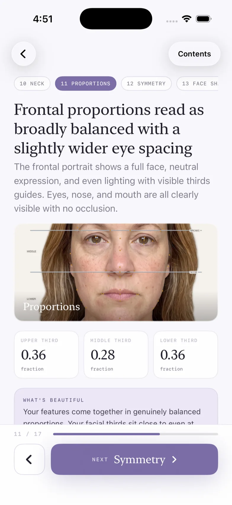 Mevona — dossier facial, section proportions